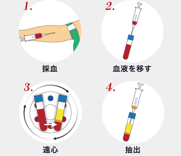1. 採血 → 2. 血液を移す → 3. 遠心 → 4. 抽出 (イラスト)