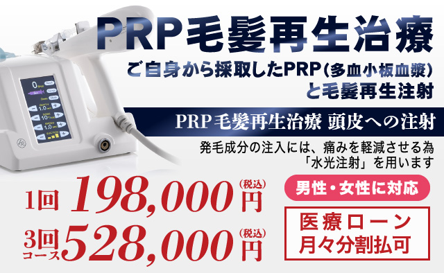 PRP毛髪再生治療