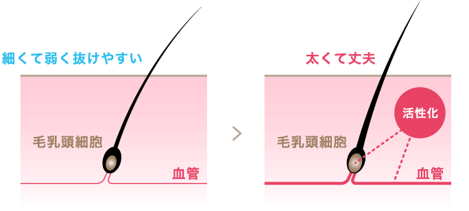 細くて弱く抜けやすい状態から太くて丈夫な毛乳頭細胞へ活性化（イラスト）