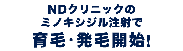 NDクリニックのミノキシジル注射で育毛・発毛開始！