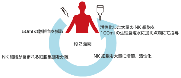 NK細胞　治療方法