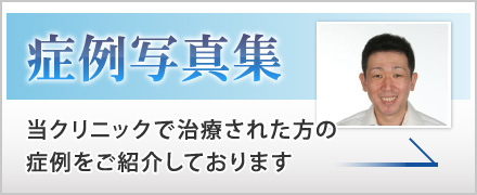 症例写真集